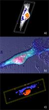 Images of glioma cells