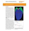 StreamLine imaging of a complete tooth