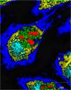 Raman image of human osteosarcoma (bone cancer) cells.