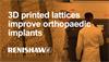 3D printed lattices improve orthopaedic implants