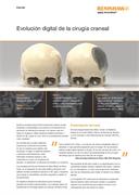 Aplicación:  Implante craneal impreso en 3D