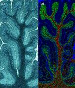 Imaging of human brain tissue