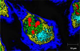 Raman image of human osteosarcoma (bone cancer) cells.