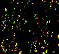 StreamLine Raman image showing inhaler active pharmaceutical ingredients