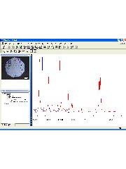 WiRE 2 panes