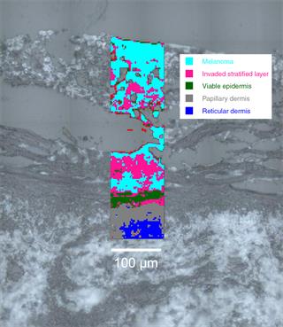 Raman image of tissue layers